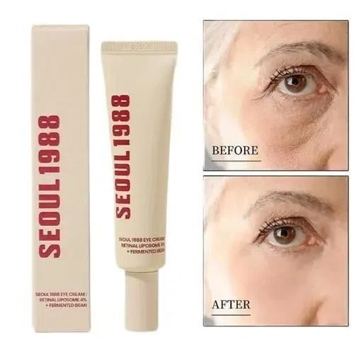 KSECRET Seoul 1988 Retinol Eye Cream – 30ml | Korean Skincare | Anti-Aging, Wrinkle Care, Brightening & Firming for All Skin Types - Available at AfnoBazar Nepal