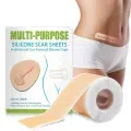 Multipurpose Silicon Gel Sheets for Professional Scar Removal for C-Section, Surgery, Burn, Keloids 4cm X 150cm - Available at AfnoBazar Nepal
