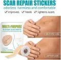 Multipurpose Silicon Gel Sheets for Professional Scar Removal for C-Section, Surgery, Burn, Keloids 4cm X 150cm - Available at AfnoBazar Nepal