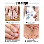 Nail Repair Cream For Toenails & Fingernails Repairs Nail Fungus And Damaged Nails 20g - Available at AfnoBazar Nepal