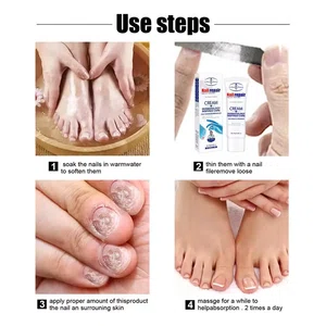 Nail Repair Cream For Toenails & Fingernails Repairs Nail Fungus And Damaged Nails 20g - Available at AfnoBazar Nepal