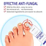 Nail Repair Cream For Toenails & Fingernails Repairs Nail Fungus And Damaged Nails 20g - Available at AfnoBazar Nepal