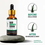 RHYN Derma Hair Growth Serum with 3% Redensyl and 4% AnaGain - 30 ml image 5
