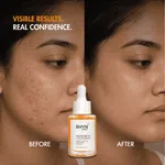 RHYN Derma TXA Face Serum with 10% Niacinamide and 4% Tranexamic Acid - 30 ml image 4