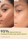 44% Rice Water Brightening Serum Pads 50 Pads - Available at AfnoBazar Nepal