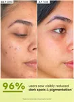 Golden Hour Glow Serum with 5% Niacinamide 30 ml - Available at AfnoBazar Nepal