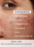 Oil Control 2% AHA and BHA Salicylic Acid Face Wash 100 g - Available at AfnoBazar Nepal