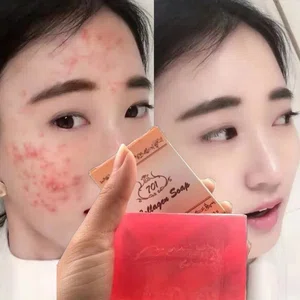 701 Collagen Plus Vitamin C and E Brightening Soap