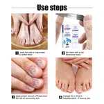 Aichun Beauty Anti-Fungal Nail Repair Cream, 20g image 5