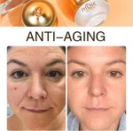 AILKE 2-in-1 Anti-Wrinkle Cream Set, 20g + 20g, Day and Night Duo image 2