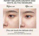 Ailke WhiteOrigin Bright Express Kojic Acid Cream Set, 25g x 2, Day and Night with Arbutin image 1