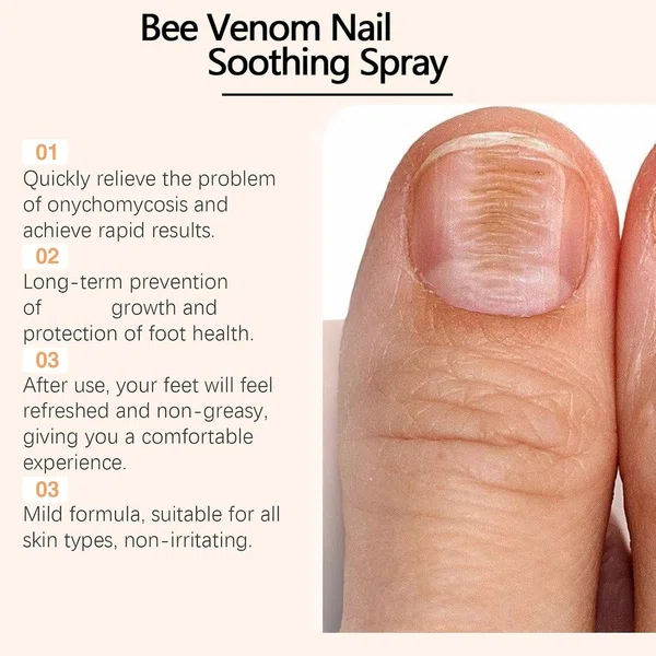 Bee Venom Nail Care Soothing Spray and Nail Strengthener