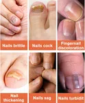 Bee Venom Nail Care Soothing Spray and Nail Strengthener image 5