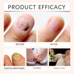 Bee Venom Nail Care Soothing Spray and Nail Strengthener image 2