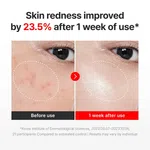CENTELLIAN 24 Madeca Cream Time Reverse, 50ml - Available at AfnoBazar Nepal
