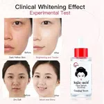 Kojic Acid Face Serum for Dark Spots and Firming - Available at AfnoBazar Nepal