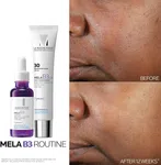 La Roche-Posay Mela B3 Intense Anti-Dark Spot Serum, 30ml, with Melasyl and 10% Niacinamide - Available at AfnoBazar Nepal