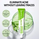 LUNDBORLY Acne Removal Cream, 20g - Available at AfnoBazar Nepal