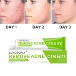 LUNDBORLY Acne Removal Cream, 20g - Available at AfnoBazar Nepal