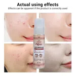 Collagen Plus Vitamin C and E Acne Removing Serum, 15ml - Available at AfnoBazar Nepal