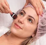 Derma Roller 0.5mm Microneedling Roller for Face, Hair and Beard - Available at AfnoBazar Nepal