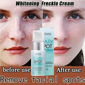 Eelhoe Dark Spot Corrector Serum, 30g - Available at AfnoBazar Nepal