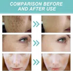 Eelhoe Dark Spot Corrector Serum, 30g - Available at AfnoBazar Nepal