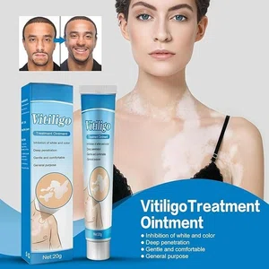 Vitiligo Care Ointment for White Spots and Leukoplakia, 20g - Available at AfnoBazar Nepal