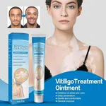 Vitiligo Care Ointment for White Spots and Leukoplakia, 20g - Available at AfnoBazar Nepal