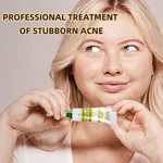 Herbal Skin Doctor Olive Anti-Acne Cream, 30g - Available at AfnoBazar Nepal