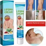 South Moon Lipoma Cream for Body Fat Lumps, Topical Herbal Formula - Available at AfnoBazar Nepal