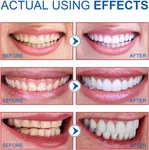 SP-6 Ultra Whitening Probiotic Toothpaste - Available at AfnoBazar Nepal