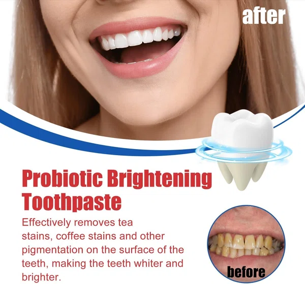 SP-6 Ultra Whitening Probiotic Toothpaste - Available at AfnoBazar Nepal