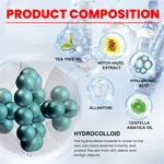 Star Hydrocolloid Pimple Patches, 200 Dots - Available at AfnoBazar Nepal