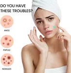 Star Hydrocolloid Pimple Patches, 200 Dots - Available at AfnoBazar Nepal