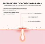 Star Hydrocolloid Pimple Patches, 200 Dots - Available at AfnoBazar Nepal