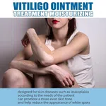 Vitiligo Care Ointment for White Spots and Leukoplakia, 20g - Available at AfnoBazar Nepal