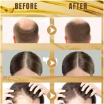 Wellice Advanced Onion Oil for Hair Growth, 150ml, Onion and Coconut Blend - Available at AfnoBazar Nepal