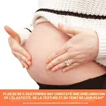 Palmer's Cocoa Butter Formula Massage Cream for Stretch Marks, 125g - Available at AfnoBazar Nepal