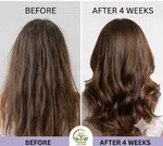 Welcare Rosemary Hair Growth Shampoo, 100% Natural Ingredients - Available at AfnoBazar Nepal
