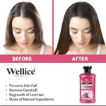 Wellice Advanced Onion Oil for Hair Growth, 150ml, Onion and Coconut Blend - Available at AfnoBazar Nepal