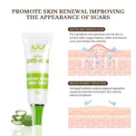 Herbal Skin Doctor Anti-Acne Cream, 30g, Olive or Aloe Vera - Available at AfnoBazar Nepal