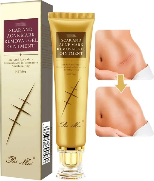 Scar and Acne Mark Removal Gel Ointment - Available at AfnoBazar Nepal