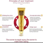Scar and Acne Mark Removal Gel Ointment - Available at AfnoBazar Nepal