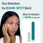 Karite Blemish Repair Fresh Mask, Pack of 5, 30ml Each - Available at AfnoBazar Nepal