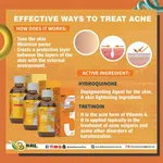 RDL Babyface Solution 2 with Hydroquinone and Tretinoin, 60ml - Available at AfnoBazar Nepal