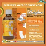 RDL Babyface Whitening and Anti-Acne Solution, 60ml, Hydroquinone and Tretinoin - Available at AfnoBazar Nepal