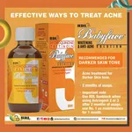 RDL Babyface Solution 2 with Hydroquinone and Tretinoin, 60ml - Available at AfnoBazar Nepal