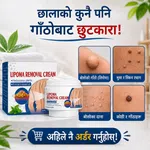 Lipoma Remover Cream - Targeted Skin Care Cream for Lipoma-Prone Areas - Available at AfnoBazar Nepal