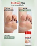 HeelGuard Plus Cracked Heel & Antifungal Repair Cream - Available at AfnoBazar Nepal